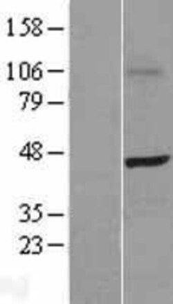 Novus Biologicals&trade;&nbsp;SKAP55 Overexpression Lysate