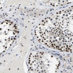 SKAR Antibody, Novus Biologicals 0.1mL; Unlabeled:Antibodies, Polyclonal