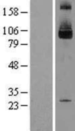 Novus Biologicals™ SKI Overexpression Lysate