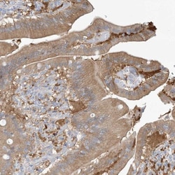 SKIP Antibody, Novus Biologicals 25 &mu;L | Buy Online | Novus Biologicals | Fisher Scientific