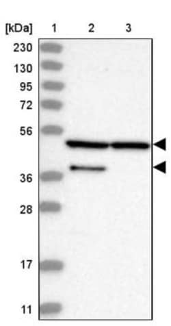 SKIP Antibody, Novus Biologicals 25 &mu;L | Buy Online | Novus Biologicals | Fisher Scientific