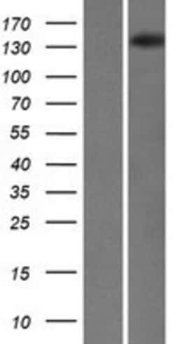 Novus Biologicals&trade;&nbsp;SKIV2L Overexpression Lysate