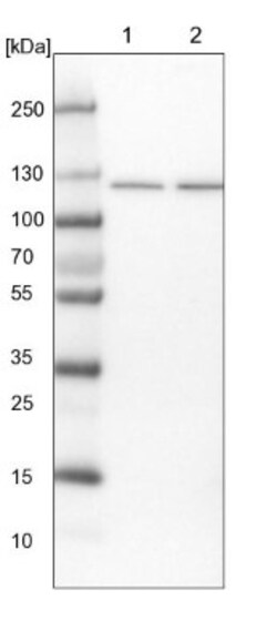 SKIV2L2 Antibody, Novus Biologicals:Antibodies:Primary Antibodies