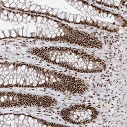 SKIV2L2 Antibody, Novus Biologicals:Antibodies:Primary Antibodies