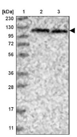 SKIV2L2 Antibody, Novus Biologicals:Antibodies:Primary Antibodies