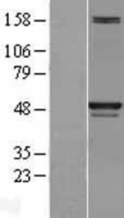 Novus Biologicals&trade;&nbsp;Skp2 Overexpression Lysate