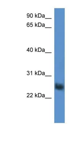 SLA2 Antibody, Novus Biologicals:Antibodies:Primary Antibodies