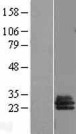 Novus Biologicals&trade;&nbsp;SLA2 Overexpression Lysate