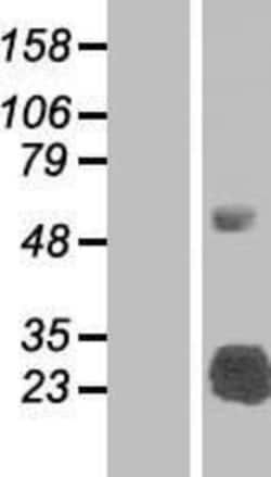 Novus Biologicals&trade;&nbsp;SLA2 Overexpression Lysate