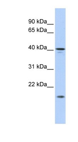 SLAIN1 Antibody, Novus Biologicals:Antibodies:Primary Antibodies