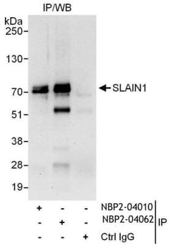 SLAIN1 Antibody, Novus Biologicals 0.1mg; Unlabeled:Antibodies, Polyclonal