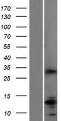 Novus Biologicals&trade;&nbsp;Slap Overexpression Lysate