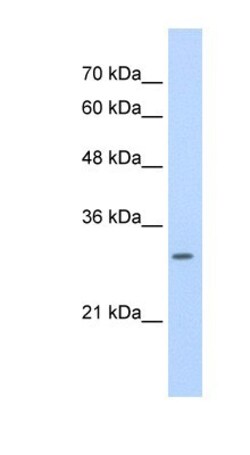 SLBP Antibody, Novus Biologicals 0.05mg; Unlabeled:Antibodies, Polyclonal