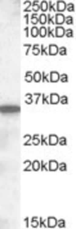 SLC10A2 Antibody, Novus Biologicals 0.1mg; Unlabeled:Antibodies, Polyclonal