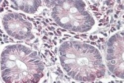 SLC10A2 Antibody, Novus Biologicals 0.1mg; Unlabeled:Antibodies, Polyclonal