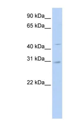 SLC10A4 Antibody, Novus Biologicals 100 &mu;L | Buy Online | Novus Biologicals | Fisher Scientific