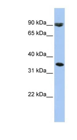 SLC10A7 Antibody, Novus Biologicals:Antibodies:Primary Antibodies