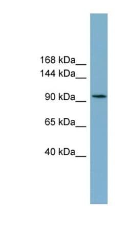 SLC12A3 Antibody, Novus Biologicals 0.05mg; Unlabeled:Antibodies, Polyclonal