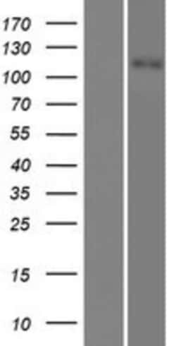 Novus Biologicals&trade;&nbsp;SLC12A3 Overexpression Lysate