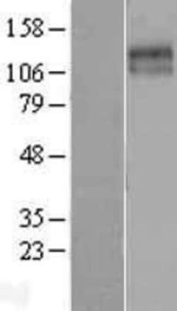Novus Biologicals&trade;&nbsp;KCC2/SLC12A5 Overexpression Lysate