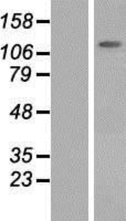 Novus Biologicals&trade;&nbsp;KCC3/SLC12A6 Overexpression Lysate