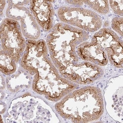 SLC13A1 Antibody, Novus Biologicals:Antibodies:Primary Antibodies