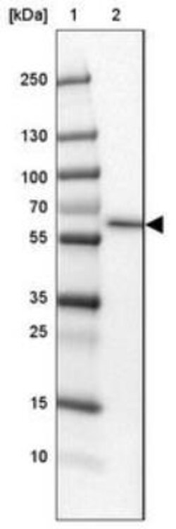 SLC13A1 Antibody, Novus Biologicals 0.1mL; Unlabeled:Antibodies, Polyclonal