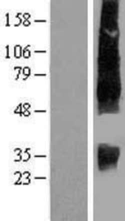 Novus Biologicals™ SLC13A2 Overexpression Lysate