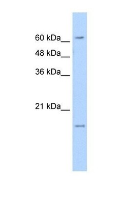 SLC13A3/NaDC3 Antibody, Novus Biologicals 100 ul; Unconjugated:Antibodies,