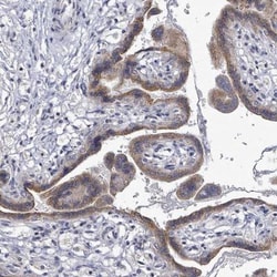 SLC13A4 Antibody, Novus Biologicals 0.1mL; Unlabeled:Antibodies, Polyclonal