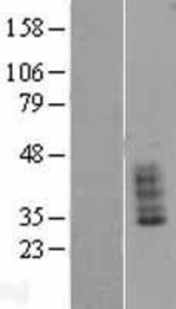 Novus Biologicals™ SLC14A1 Overexpression Lysate