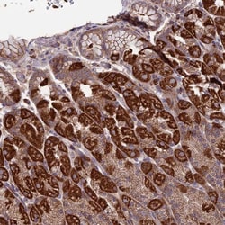 SLC15A5 Antibody, Novus Biologicals:Antibodies:Primary Antibodies