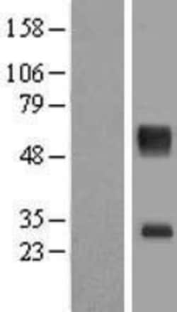 Novus Biologicals&trade;&nbsp;SLC16A11 Overexpression Lysate