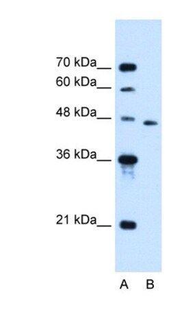 SLC16A12 Antibody, Novus Biologicals 100&mu;L; Unlabeled:Antibodies, Polyclonal