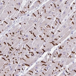 SLC16A6 Antibody, Novus Biologicals 0.1mL; Unlabeled:Antibodies, Polyclonal