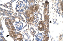 SLC17A2 Antibody, Novus Biologicals:Antibodies:Primary Antibodies