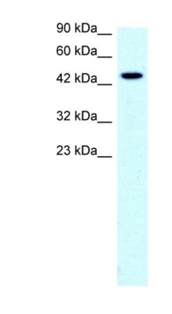 SLC17A2 Antibody, Novus Biologicals:Antibodies:Primary Antibodies