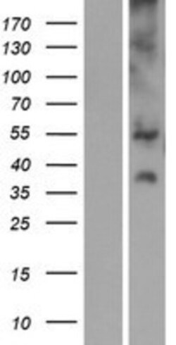 Novus Biologicals&trade;&nbsp;SLC17A3 Overexpression Lysate