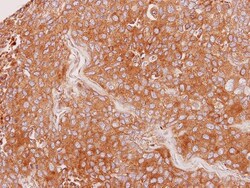 Sialin/SLC17A5 Antibody, Novus Biologicals 0.1mL; Unlabeled:Antibodies,