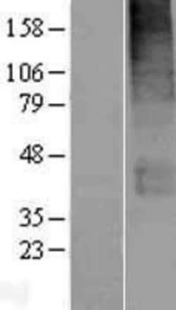 Novus Biologicals™ SLC19A3 Overexpression Lysate