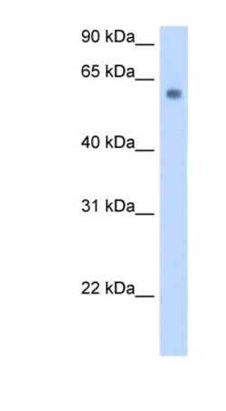 SLC1A4 Antibody, Novus Biologicals 0.05mg; Unlabeled:Antibodies, Polyclonal