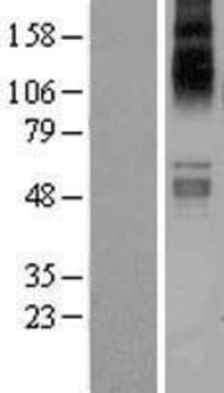 Novus Biologicals&trade;&nbsp;SLC1A7 Overexpression Lysate