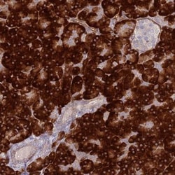 SLC1A7 Antibody, Novus Biologicals:Antibodies:Primary Antibodies