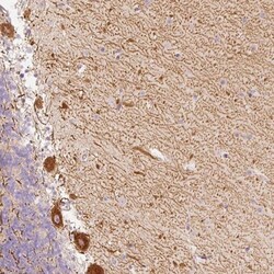 SLC20A1 Antibody, Novus Biologicals 0.1mL; Unlabeled:Antibodies, Polyclonal