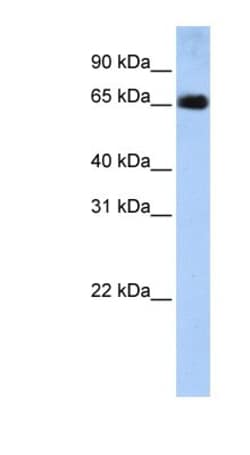 SLC22A13 Antibody, Novus Biologicals:Antibodies:Primary Antibodies