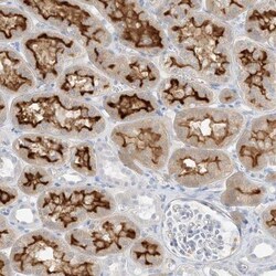 SLC22A13 Antibody, Novus Biologicals:Antibodies:Primary Antibodies