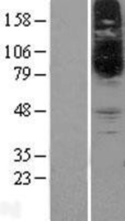 Novus Biologicals&trade;&nbsp;SLC22A15 Overexpression Lysate