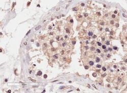 SLC22A16 Antibody, Novus Biologicals 0.1mg; Unlabeled:Antibodies, Polyclonal