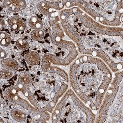 SLC22A16 Antibody, Novus Biologicals 0.1mL; Unlabeled:Antibodies, Polyclonal