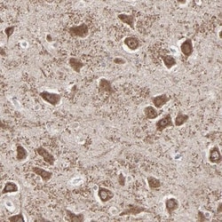SLC22A17 Antibody, Novus Biologicals 25 &mu;L; Unlabeled:Antibodies, Polyclonal